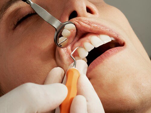 Why Are Regular Visits to a Dentist Necessary?